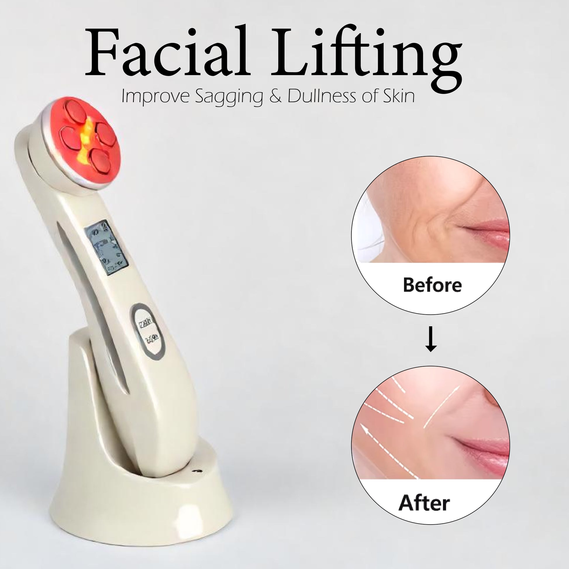 EMS LED Light Facial Lifting Machine – Electroporation & Mesotherapy Device