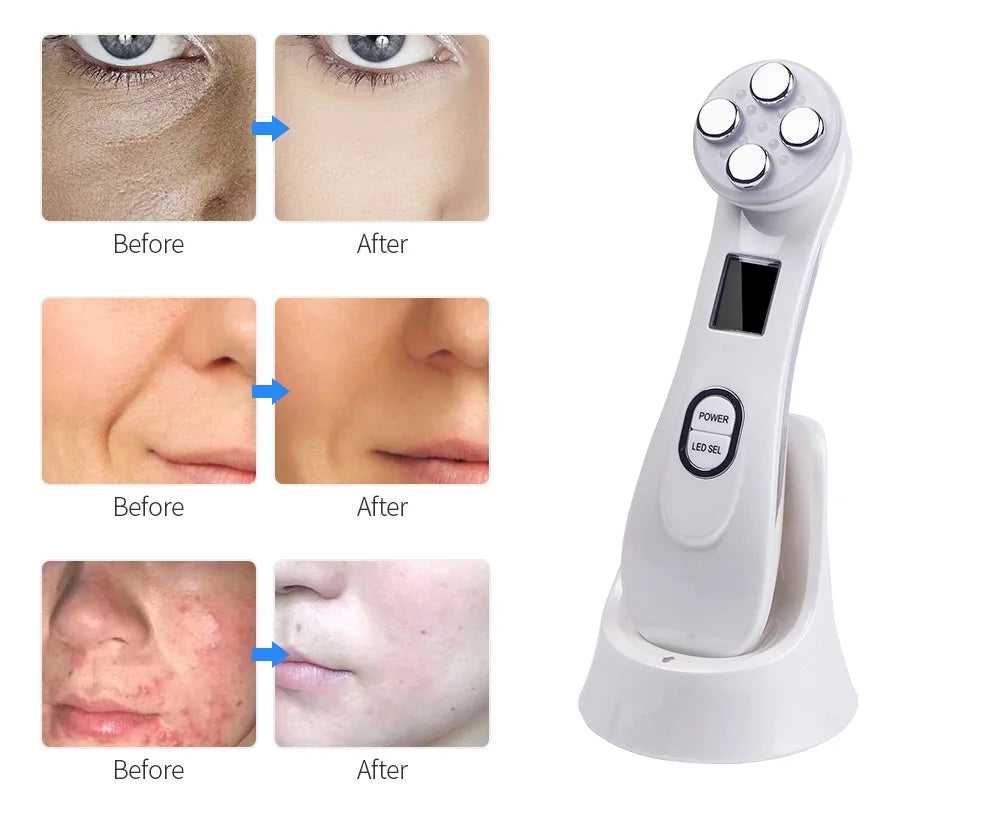 EMS Face Lifting Machine – Microcurrent Skin Firming & LED Beauty Device - Zenith Cart